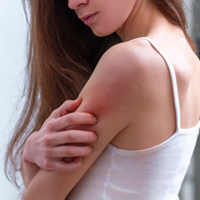 Ayurveda For Eczema: Brilliant Natural Remedies To Pacify Itching And Skin Inflammation