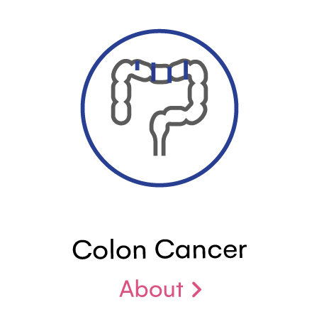 Colon Cancer